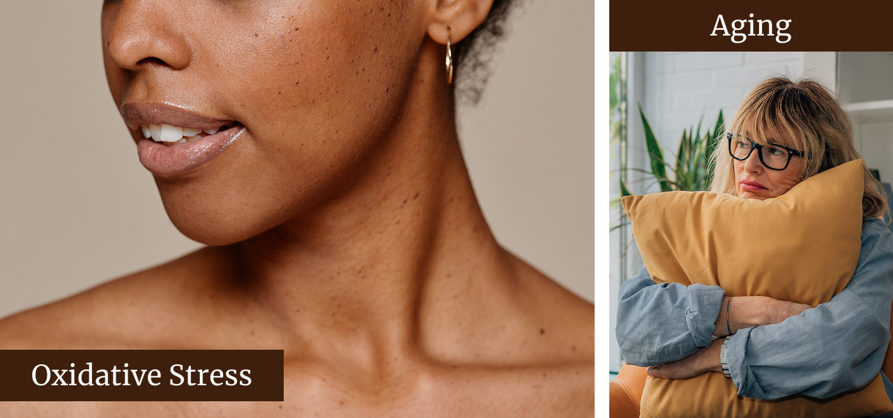 UV Rays and aging