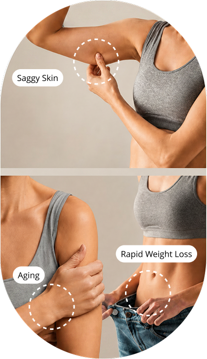 saggy skin