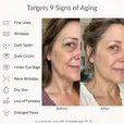 Strateva RX all in one anti aging serum targets wrinkles, dark spots, dark circles, fine lines, eye bags