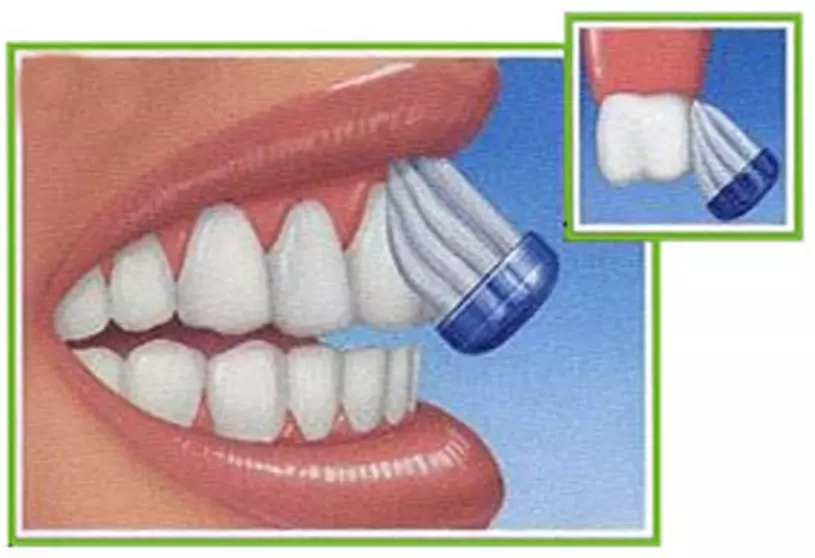 angled-brushing