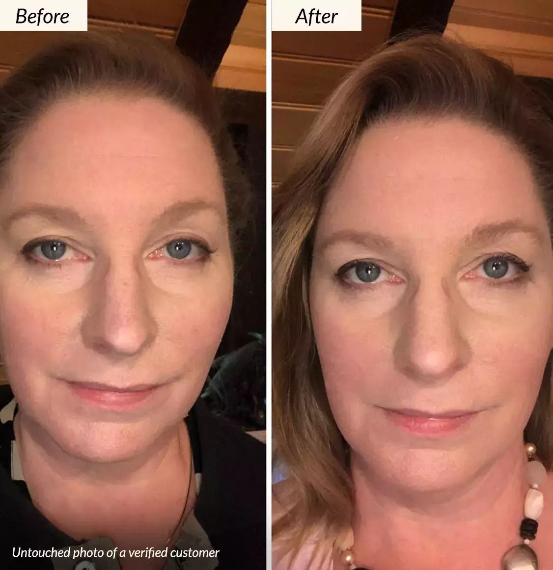 Before and After using Kesaradi Oil