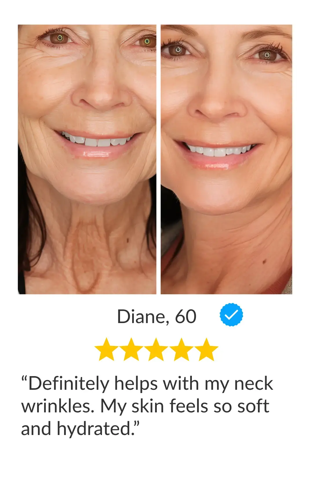 before after image showing long full lashes