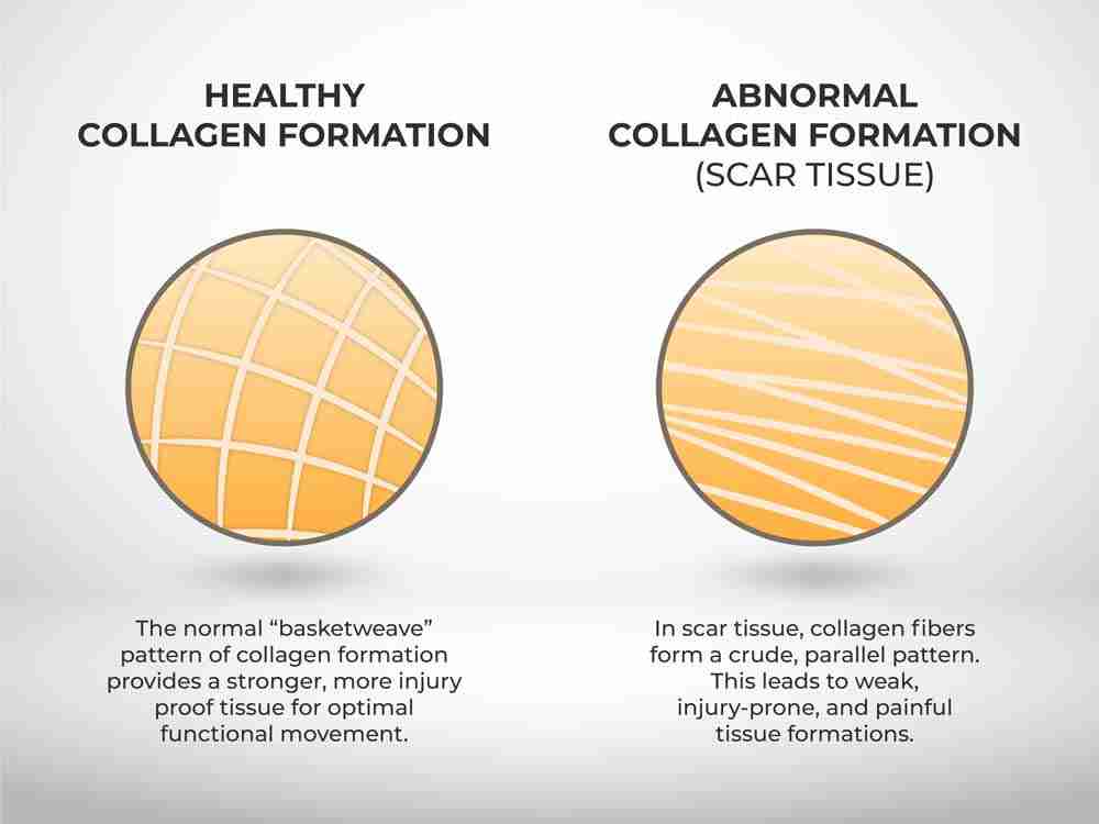 collagen synthesis supplement