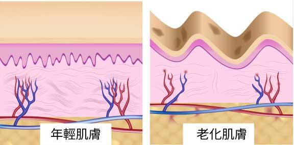 comparison between young and old skin
