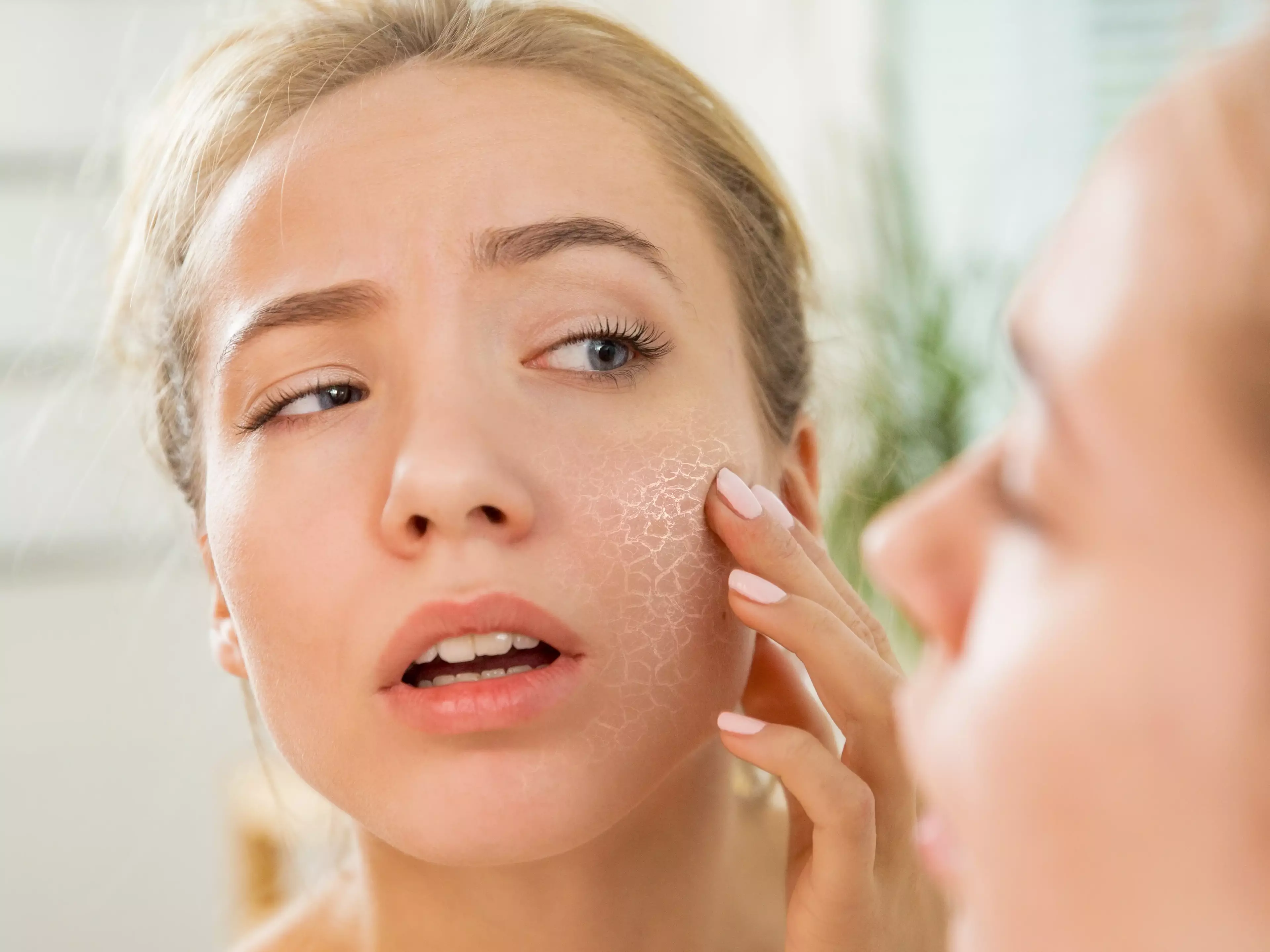 People with Very Dry or Dehydrated Skin