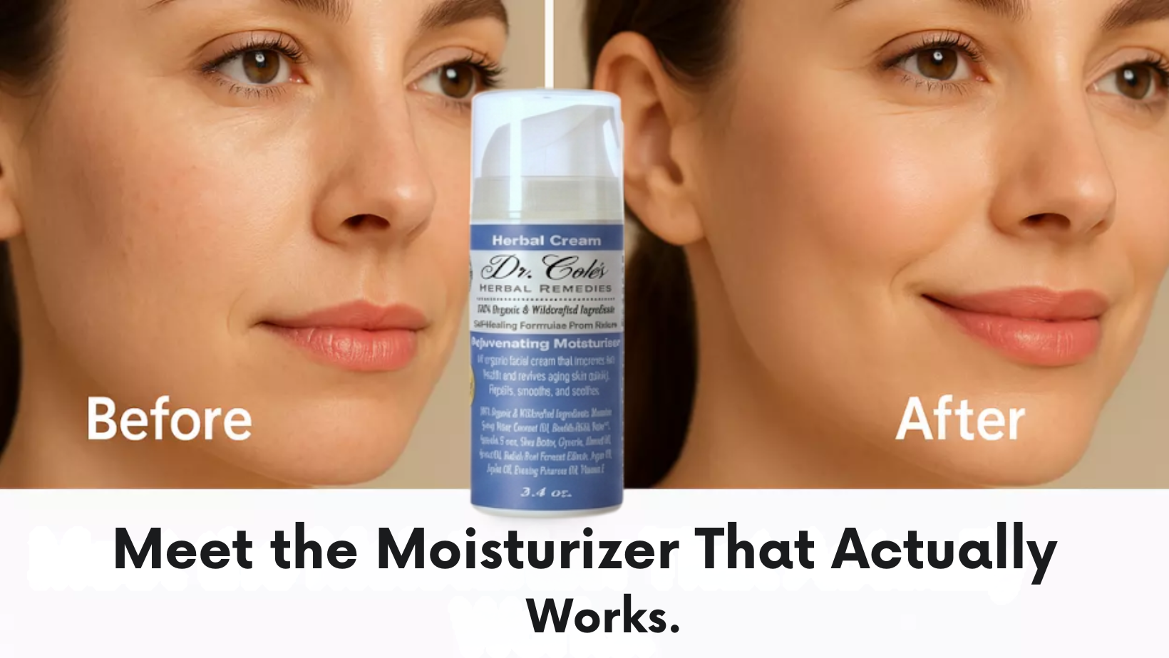 dry skin face moisturizer