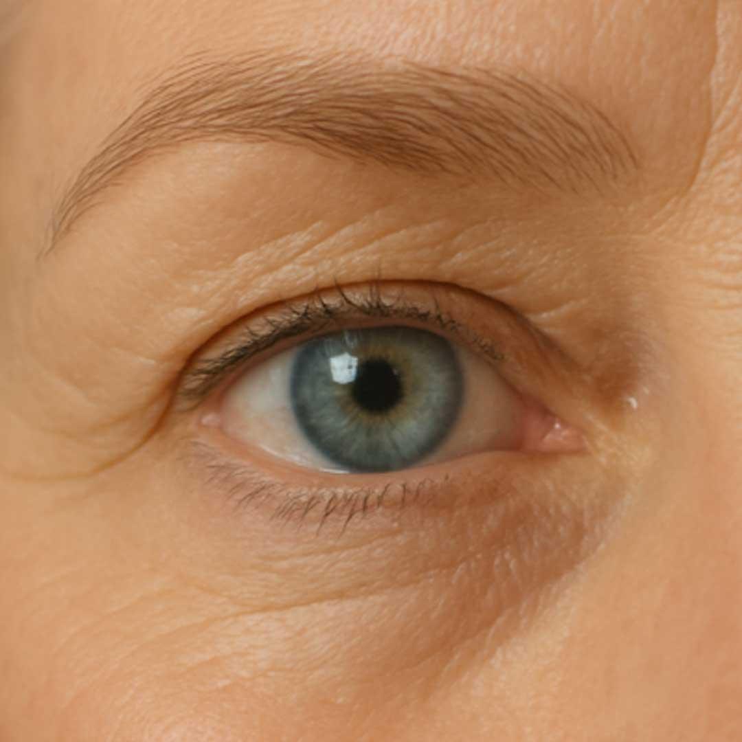 Closeup image of an eye