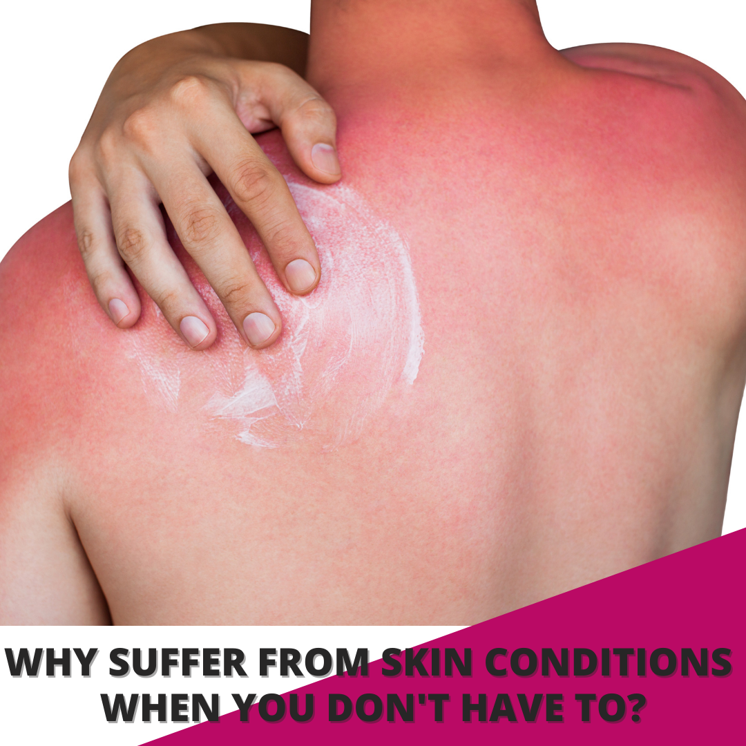 Why suffer from skin conditions when you don't have to?