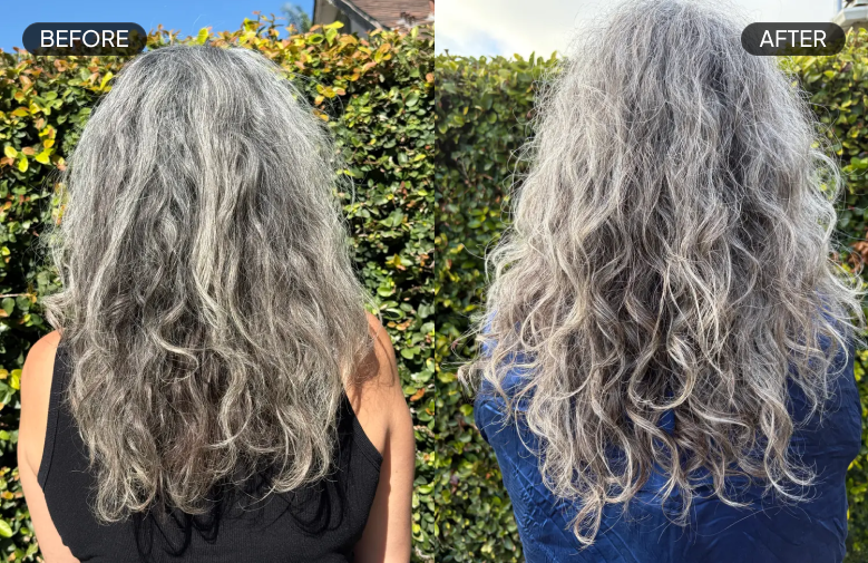 Lori R. - Before & After Review - Mobile