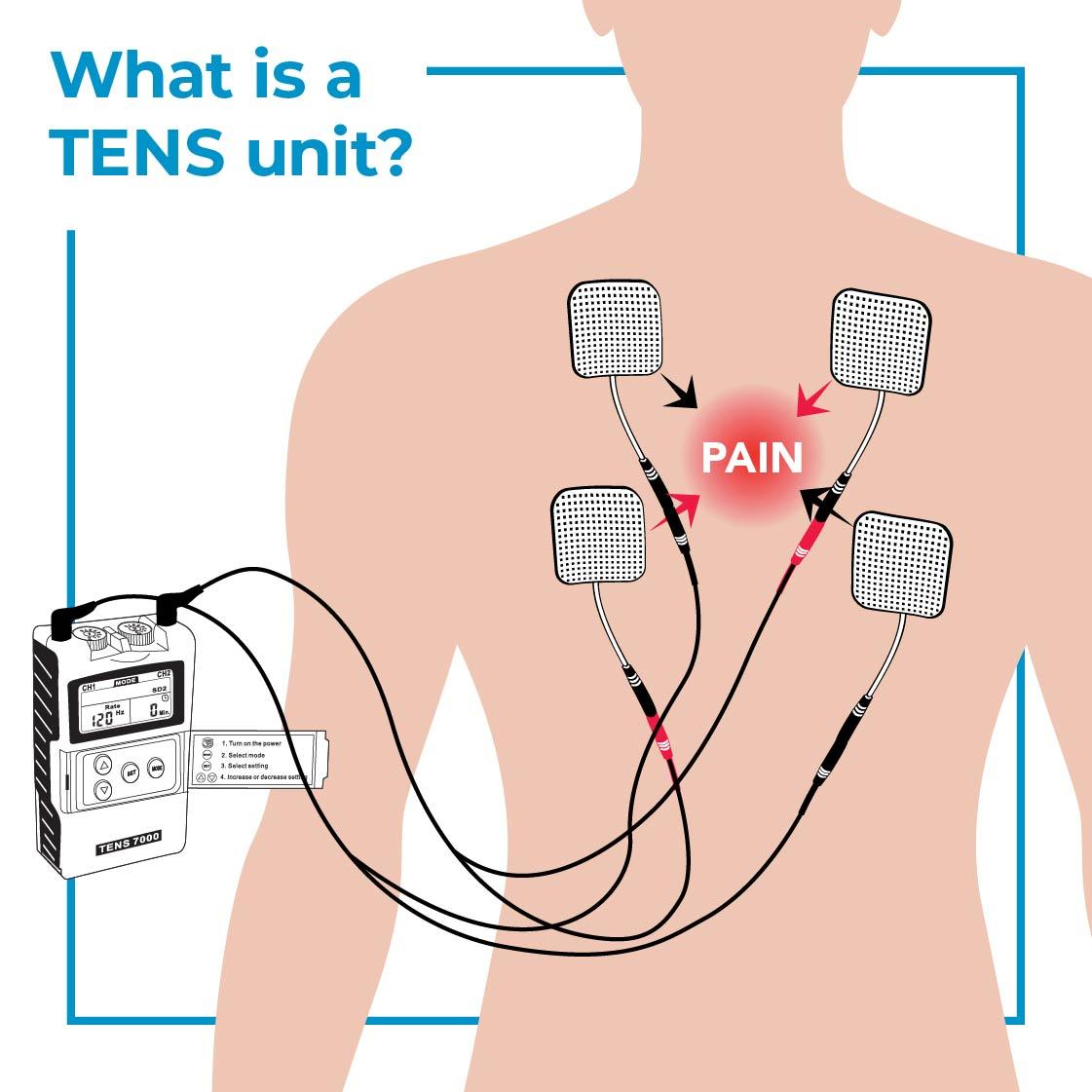 TENS Unit Electrode Placement Guide – TENS 7000