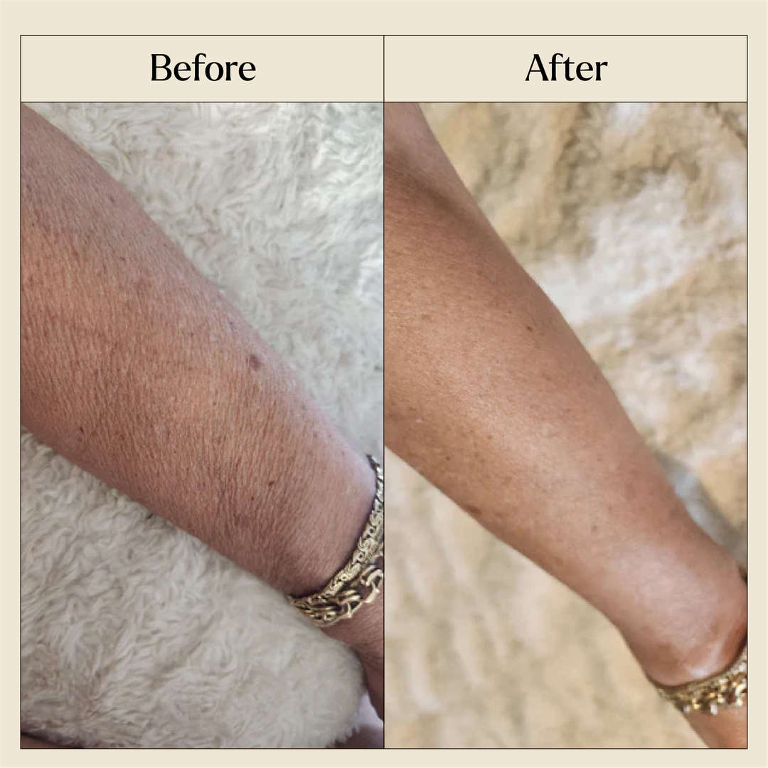 Before and After
