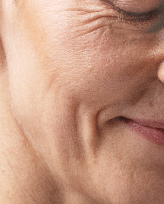 A woman showcasing Firm-Focus Face Mask clinical effects on mature skin