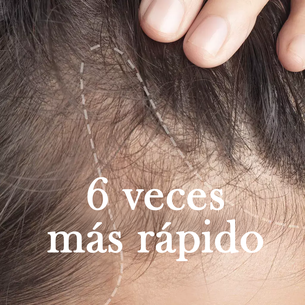 Scalp aging