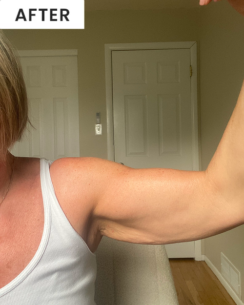 After image of customer 1