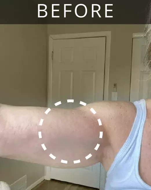 Before image of customer 1