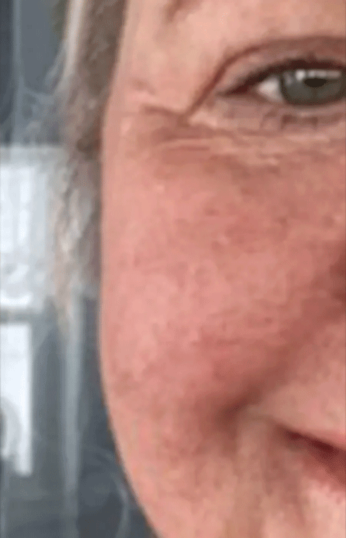 Before After GIF - Review 1