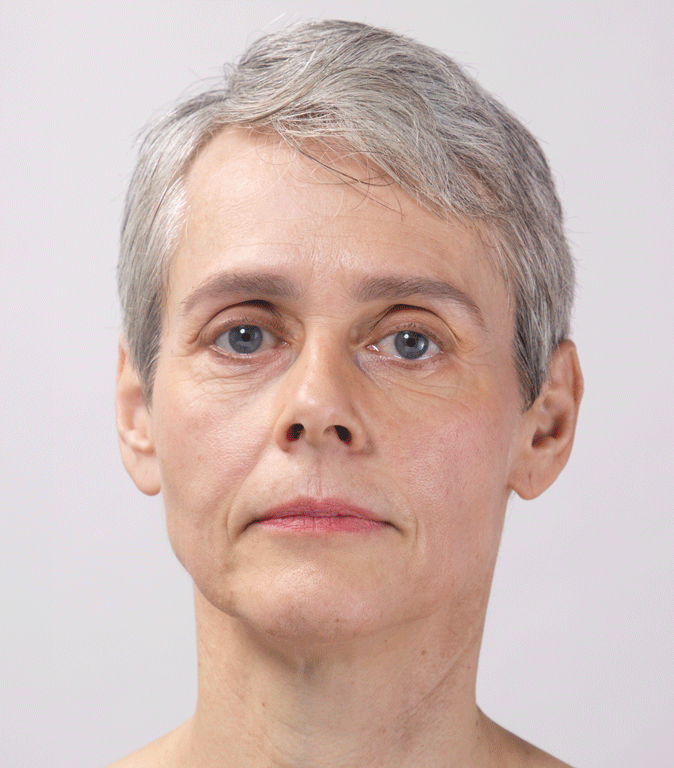 Woman using Firm-Focus Face Mask