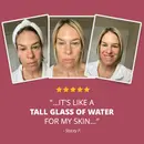 Three before-and-after photos of Stacey P., a woman with blonde hair, showing her skin transformation — from bare-faced with a hair towel to visibly hydrated and smiling. Five-star review reads: 'It's like a tall glass of water for my skin."
