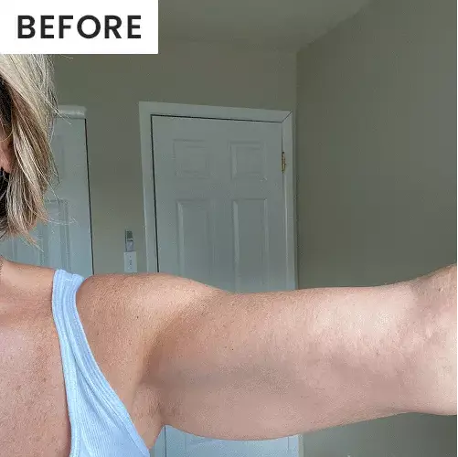 before and after