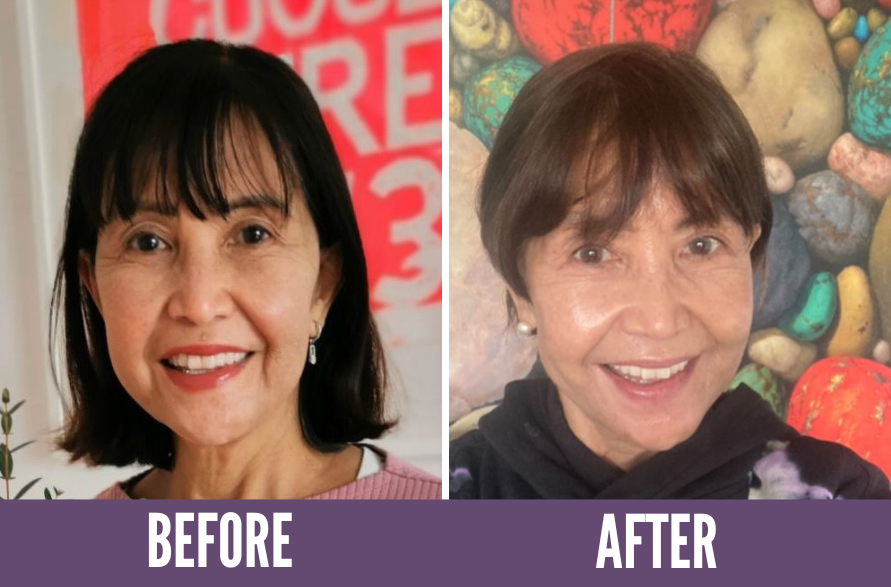 Koko Face Yoga Before/After Results