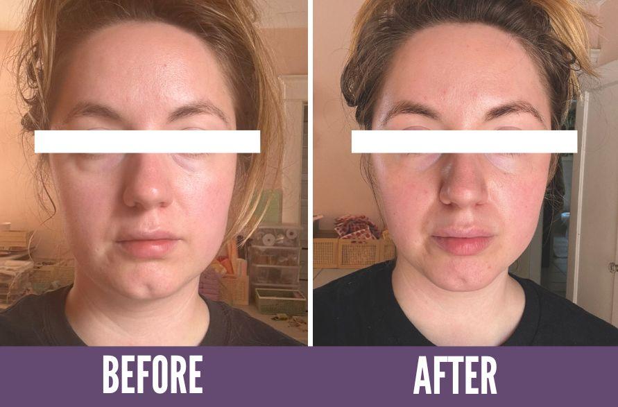 Koko Face Yoga Before/After Results