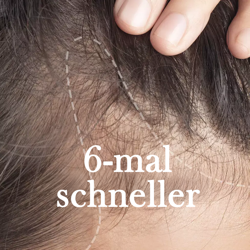 Scalp aging
