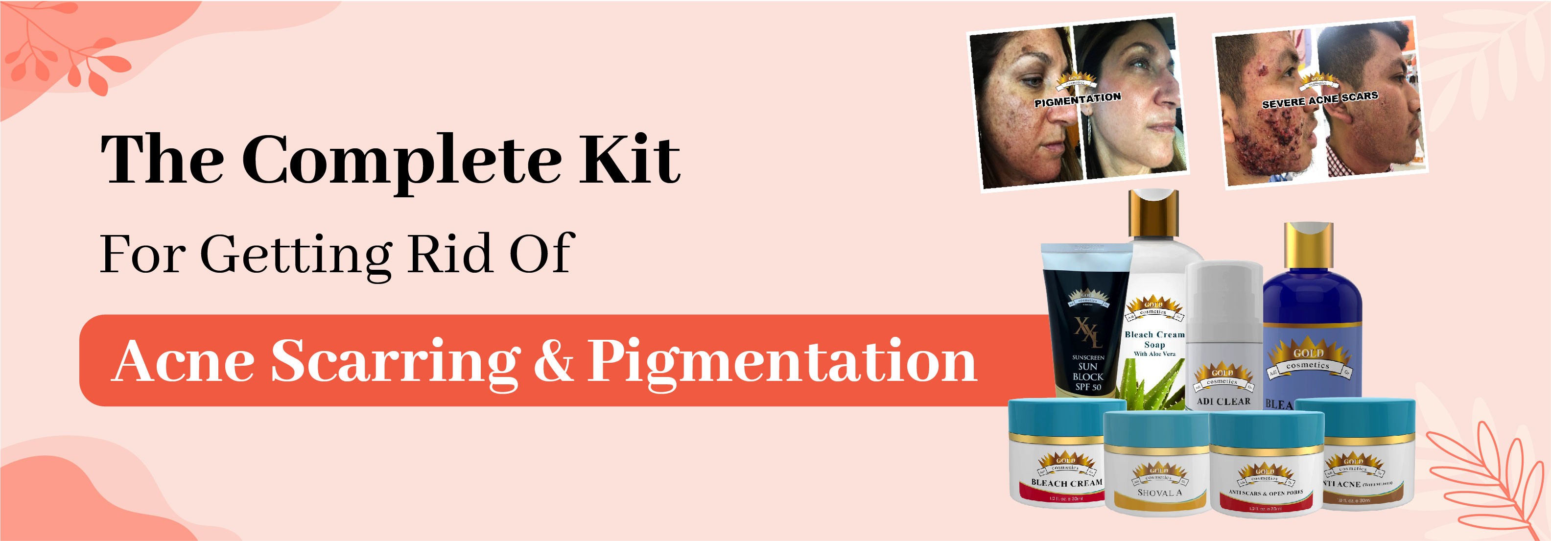 acne + pigmentation kit from gold cosmetics