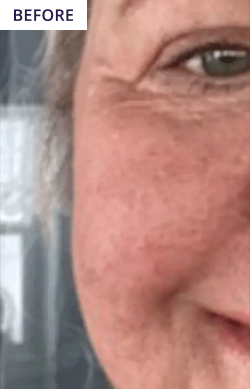 Before and After - Lynn Ledford 