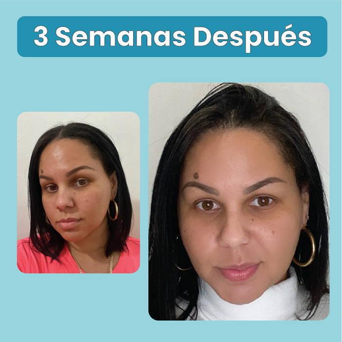 mujer cuidando su piel con el serum de vitamina c