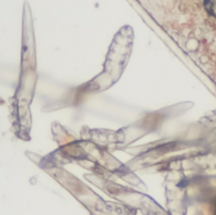 Как выглядит бельевой клещ под микроскопом фото