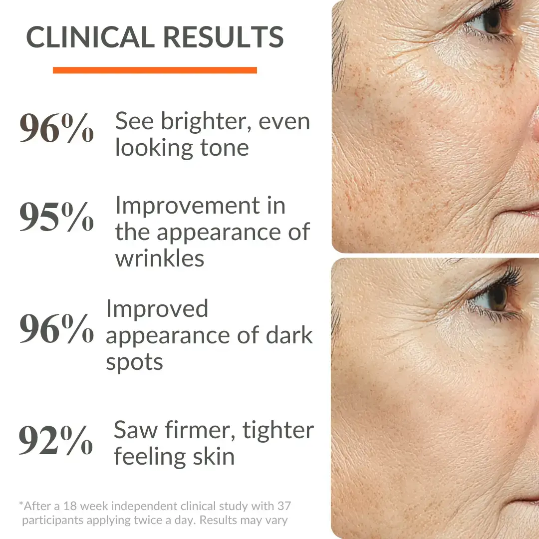 Levaye vitamin c serum clinical results 95% saw visible wrinkle improvement