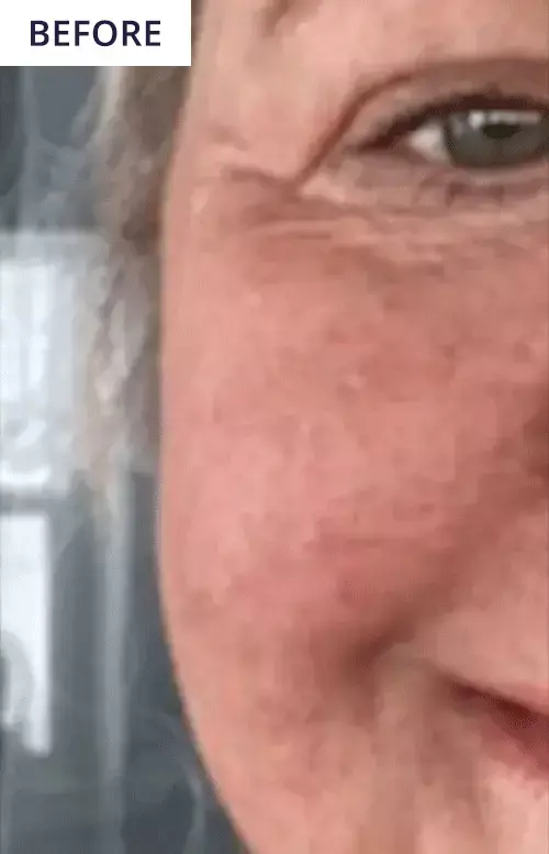 Before After GIF - Review 1