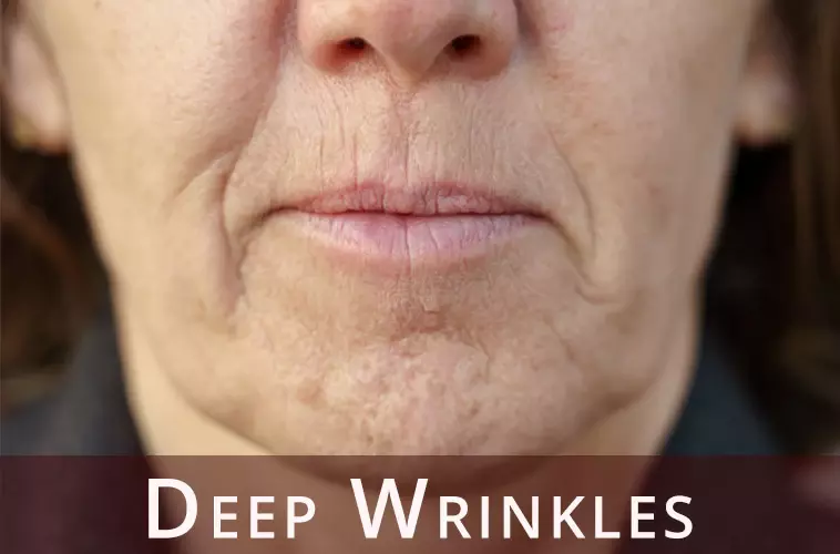 Deep Wrinkles - Desktop
