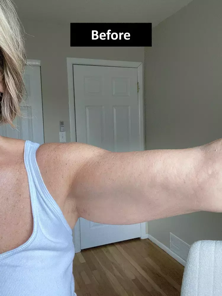 After image of customer 1