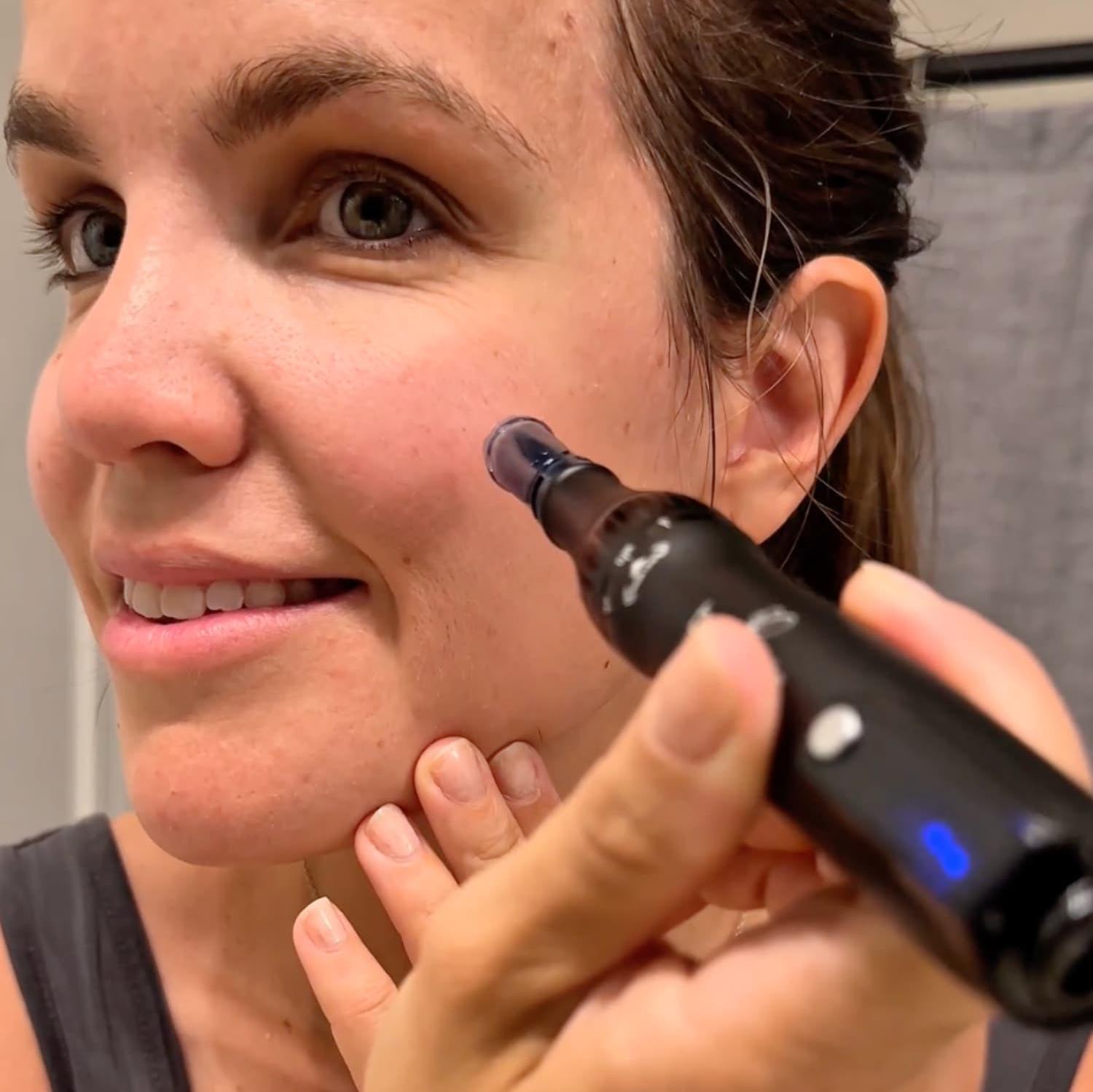 woman using derma pen on her face
