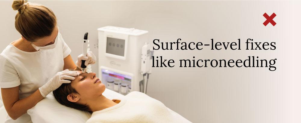 Surface-level fixes like microneedling