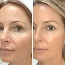 LeVaye Vitamin C serum