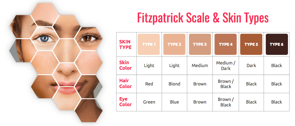 THE FITZPATRICK SCALE