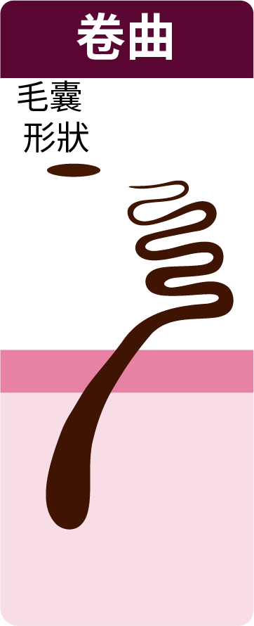 flat follicle- coily