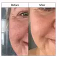 Before and after image of a consumer using the product