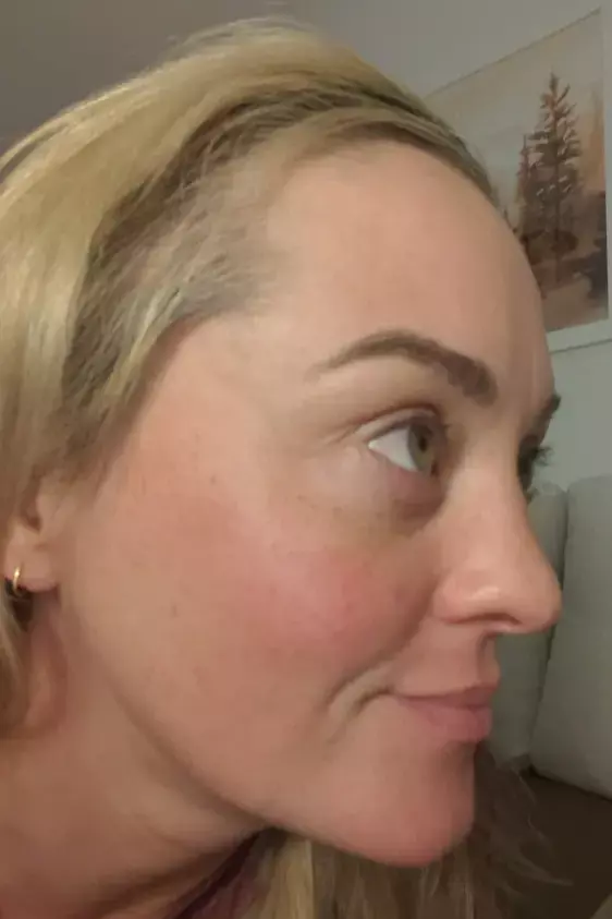 After image of customer 1