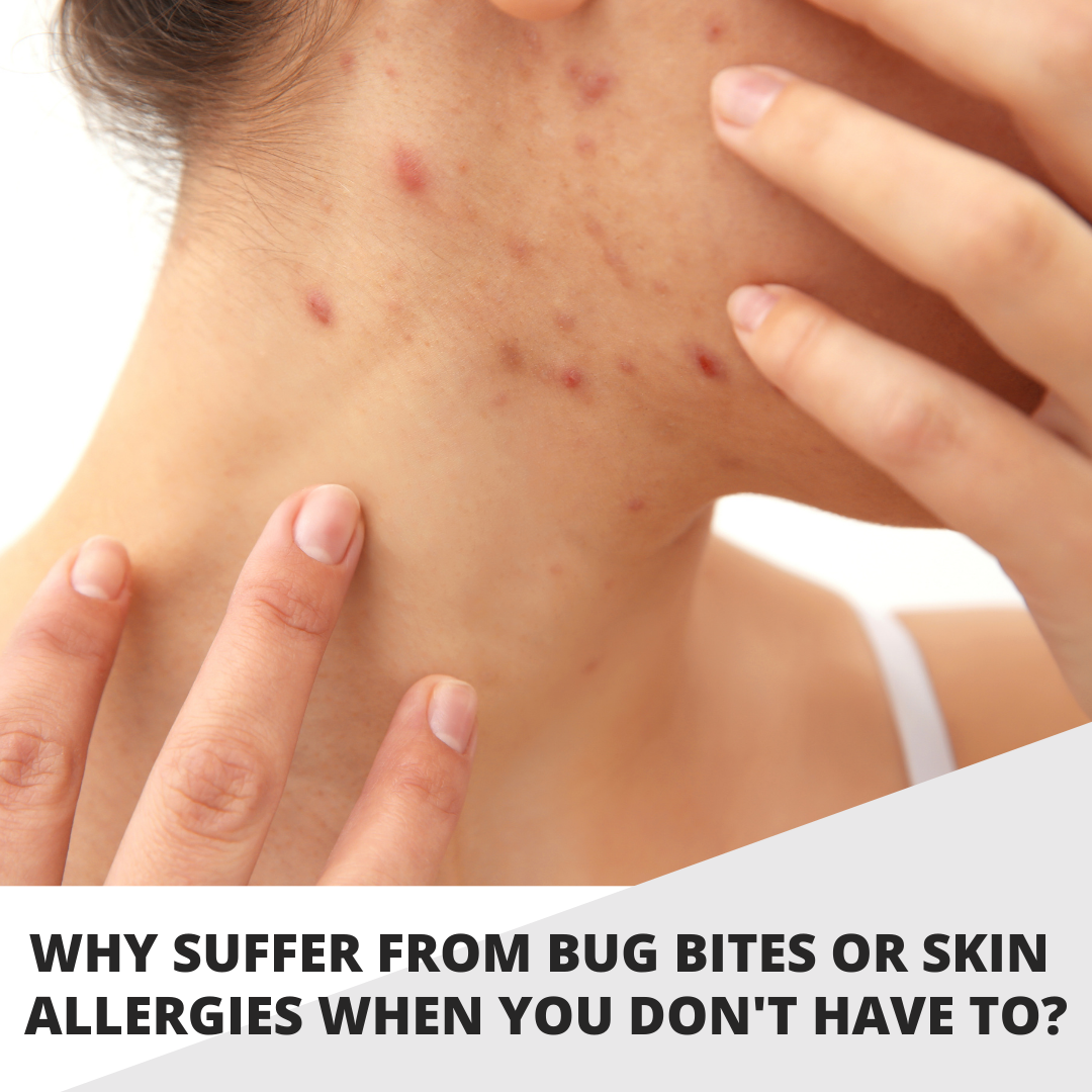 Why suffer from bug bites or skin allergies when you don't have to?