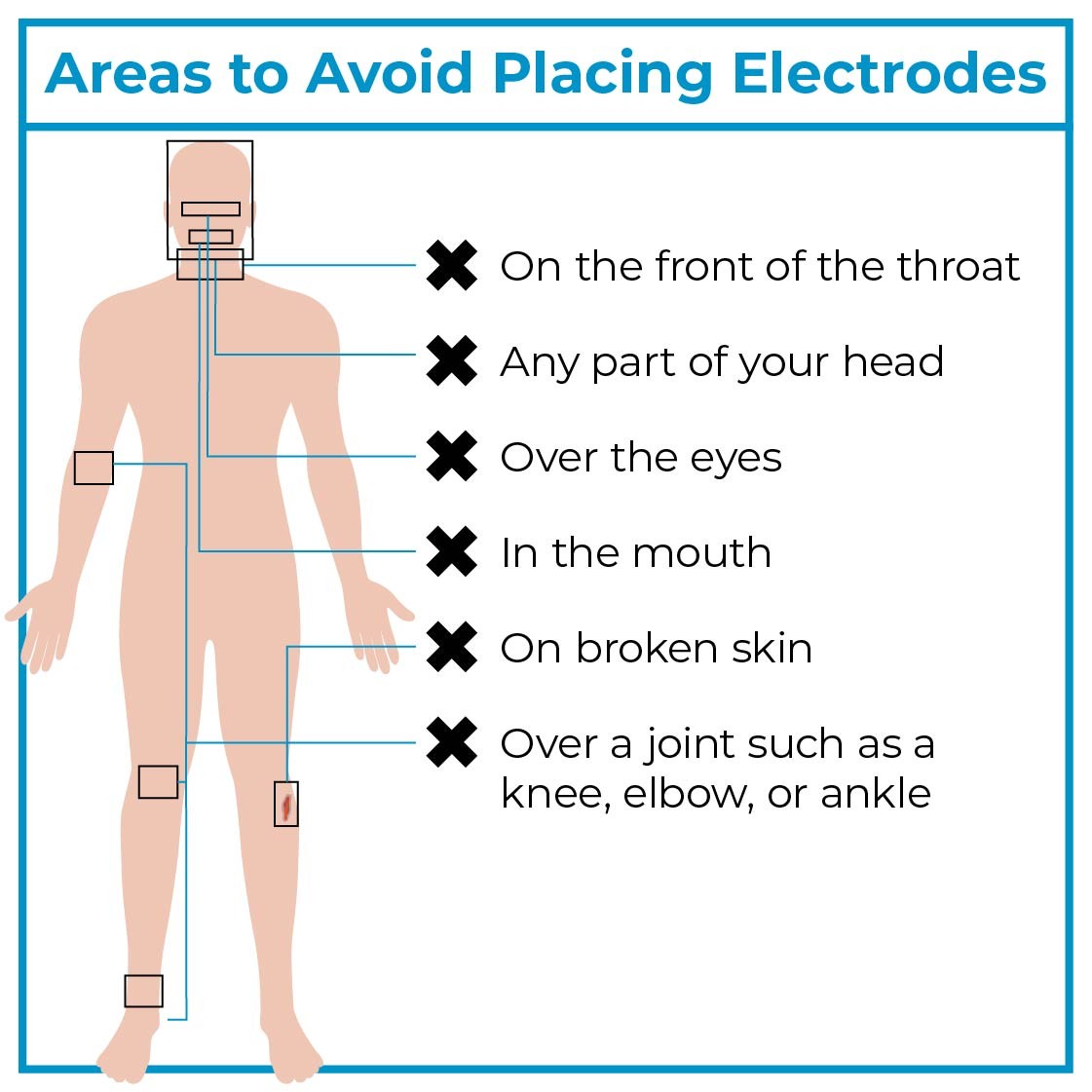 Areas to avoid placing electrodes