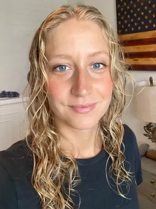 Before image of customer 4