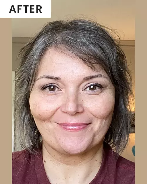 After image of customer 1