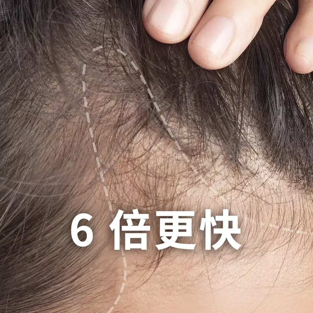 Scalp aging