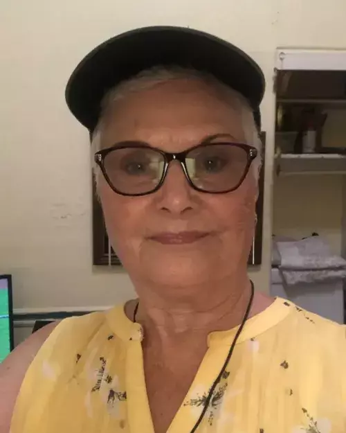 Before and after images of customer 5