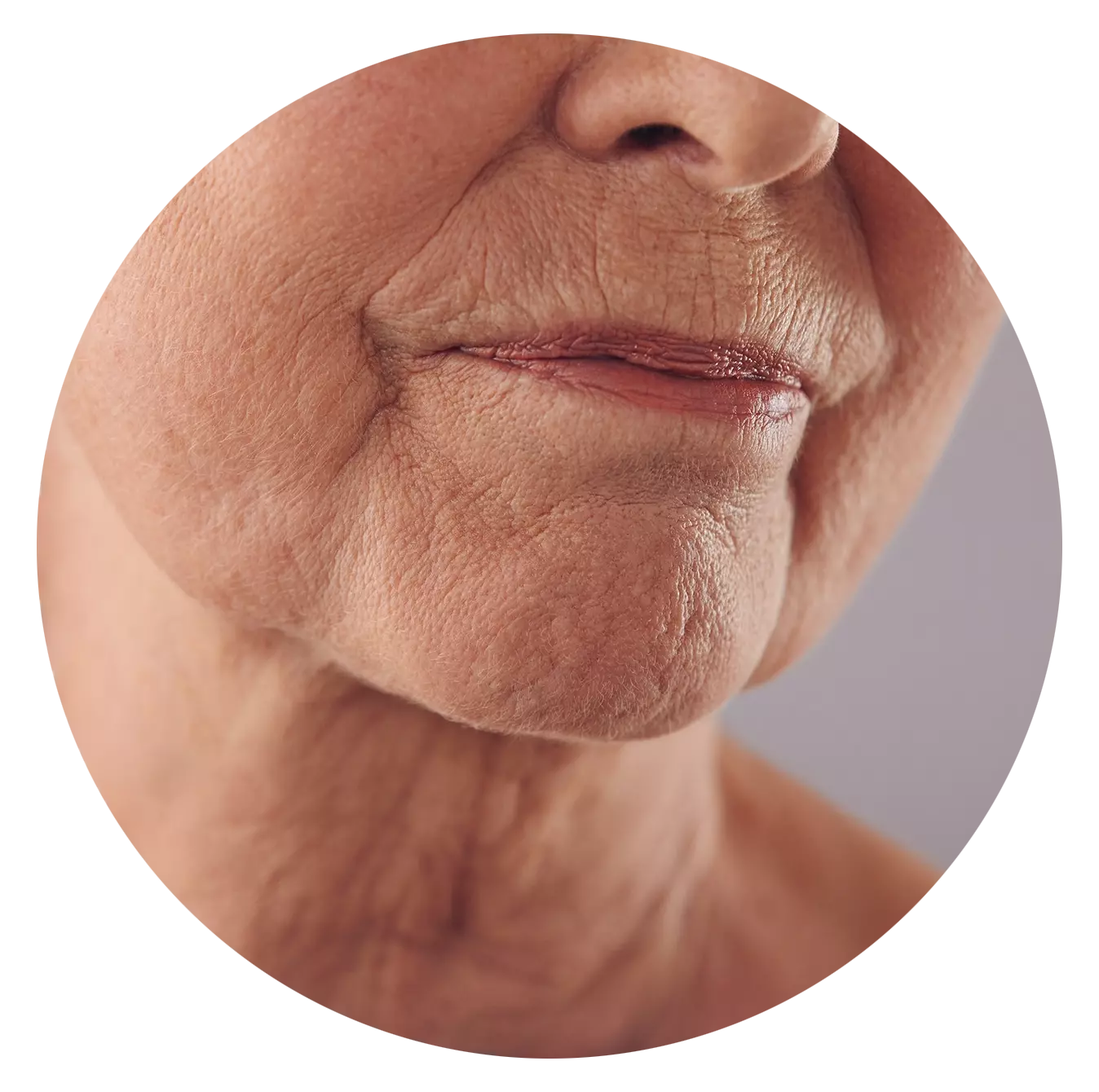 Agining - Wrinkles and Fine Lines