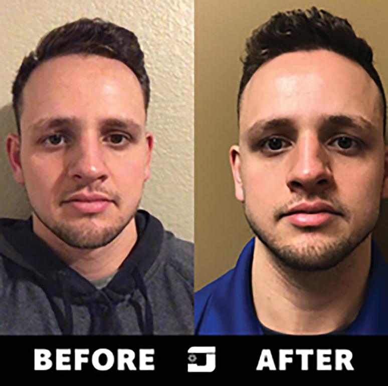 Jawzrsize Create The Ultimate Jawline, Fitness 4 Your Face Holistic