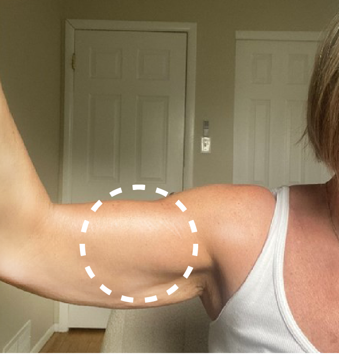 moisturized arms